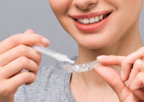 八大行業酒店兼職-酒店小姐美白牙齒妙方